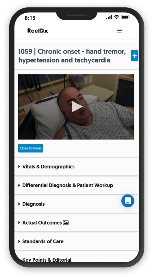 ReelDx website displayed on an iPhone